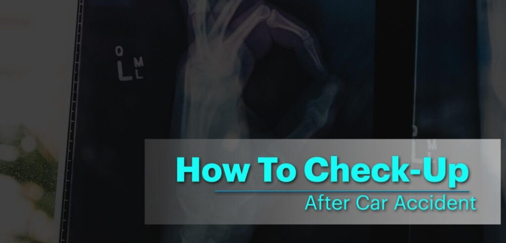 How-to-check-up-after-a-car-accident